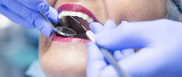 Best Dentist for Tooth Abscess  in Grandview, MO